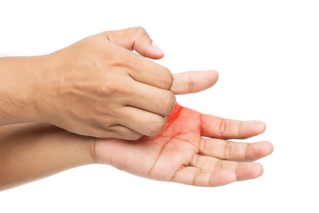 Nieze ar sēnīti un tā ārstēšanu ar demyxil krēmu